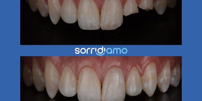 Sorridiamo Roma