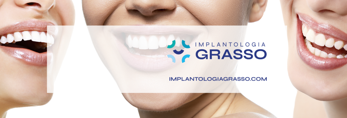 Grasso Prof. Giuseppe Dentista Implantologo e Parodontologo